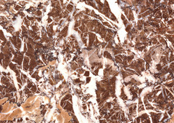 Breccia S. Agata